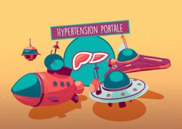 Un clip d’animation pour mieux comprendre l’hypertension portale