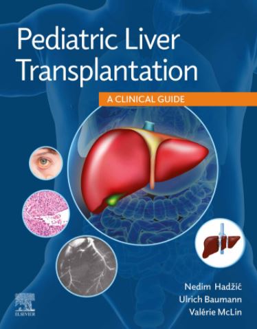Guide « Pediatric Liver Transplantation : A Clinical Guide » 