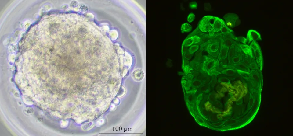 Human-derived tumor lung spheroids. Véronique Serre-Beinier, HUG, UNIGE Geneva