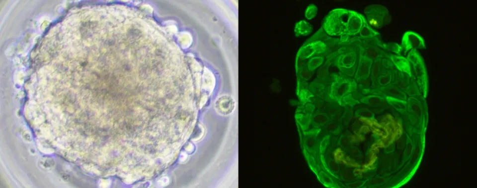 Sphéroïdes de tumeur pulmonaire d'origine humaine. Véronique Serre-Beinier, HUG, UNIGE Genève